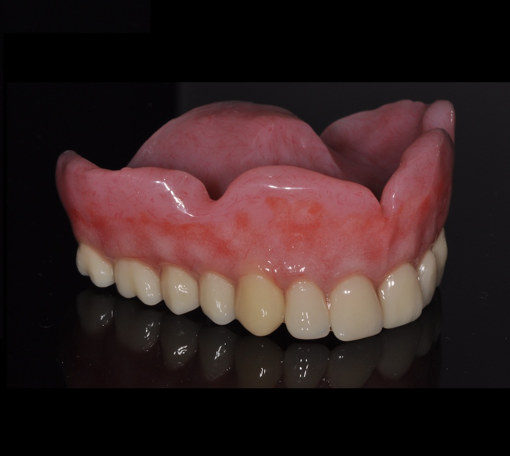 Removable Dentures Adelaide | Removable or Implant Dentures.